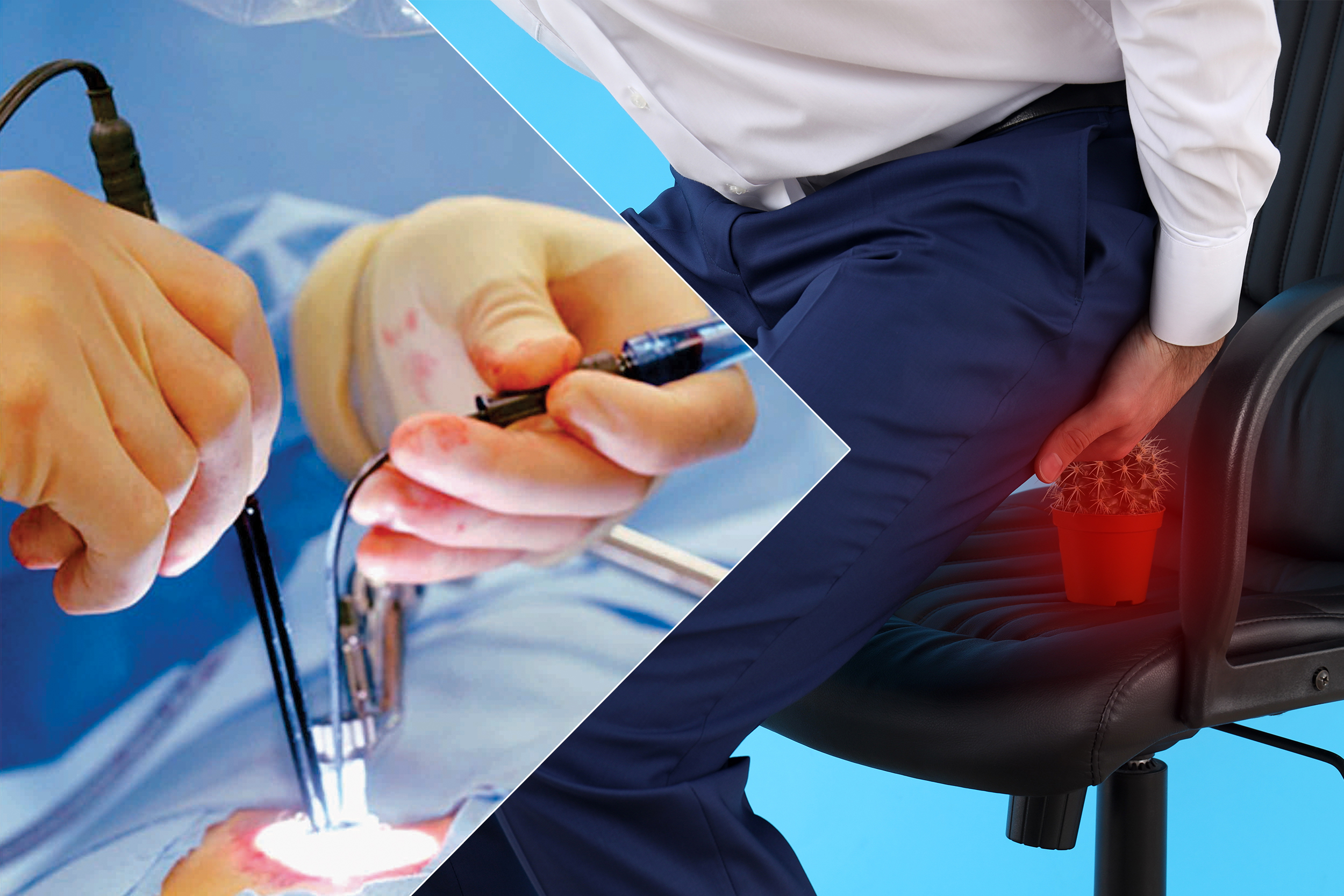 Laser procedure illustration — precision fibre, sealed tissue