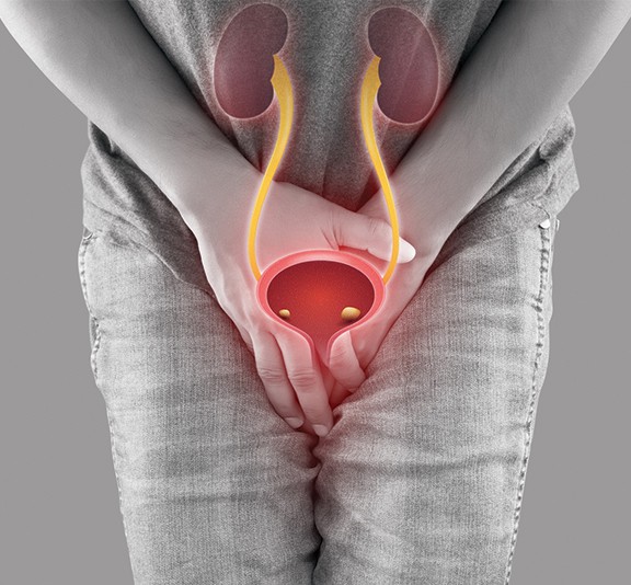 Kidney & Urinary Bladder Stone Treatment