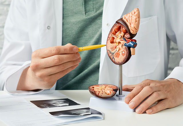 Kidney Tumour Surgery
